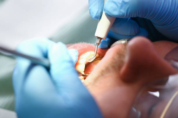 Best Emergency Treatment for Dental Infections or Abscesses in Jamestown, NC