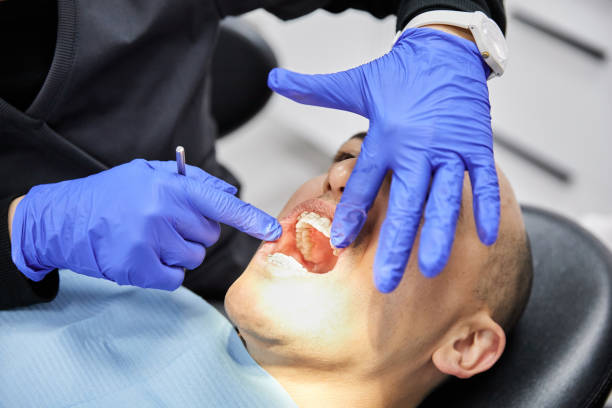 Best Emergency Dental Care for Broken or Chipped Teeth in Jamestown, NC
